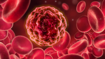 Hadronentherapie für Krebskranke picture news
