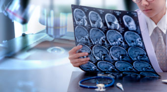 Behandlung von Schlaganfällen in 15 belgischen Krankenhäusern picture news