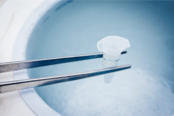 Erweiterung der Erstattung für „Oncofreezing“ picture news